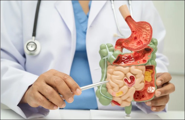 Gastroenterologen geben Darmtipps